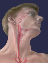 Carotid artery medical drawing